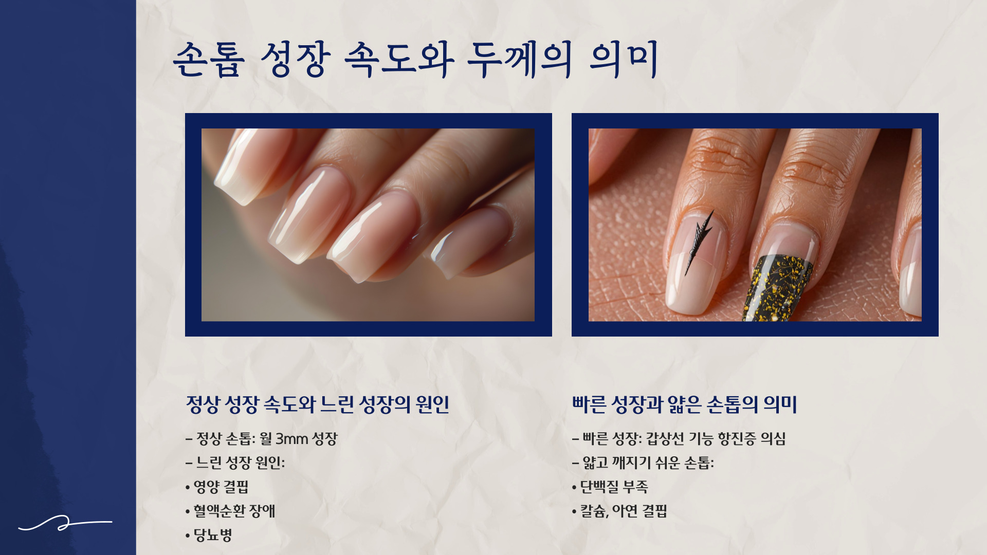 손톱으로 보는 건강상태