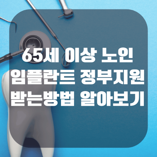65세이상 임플란트 정부지원 받는 방법 알아보기