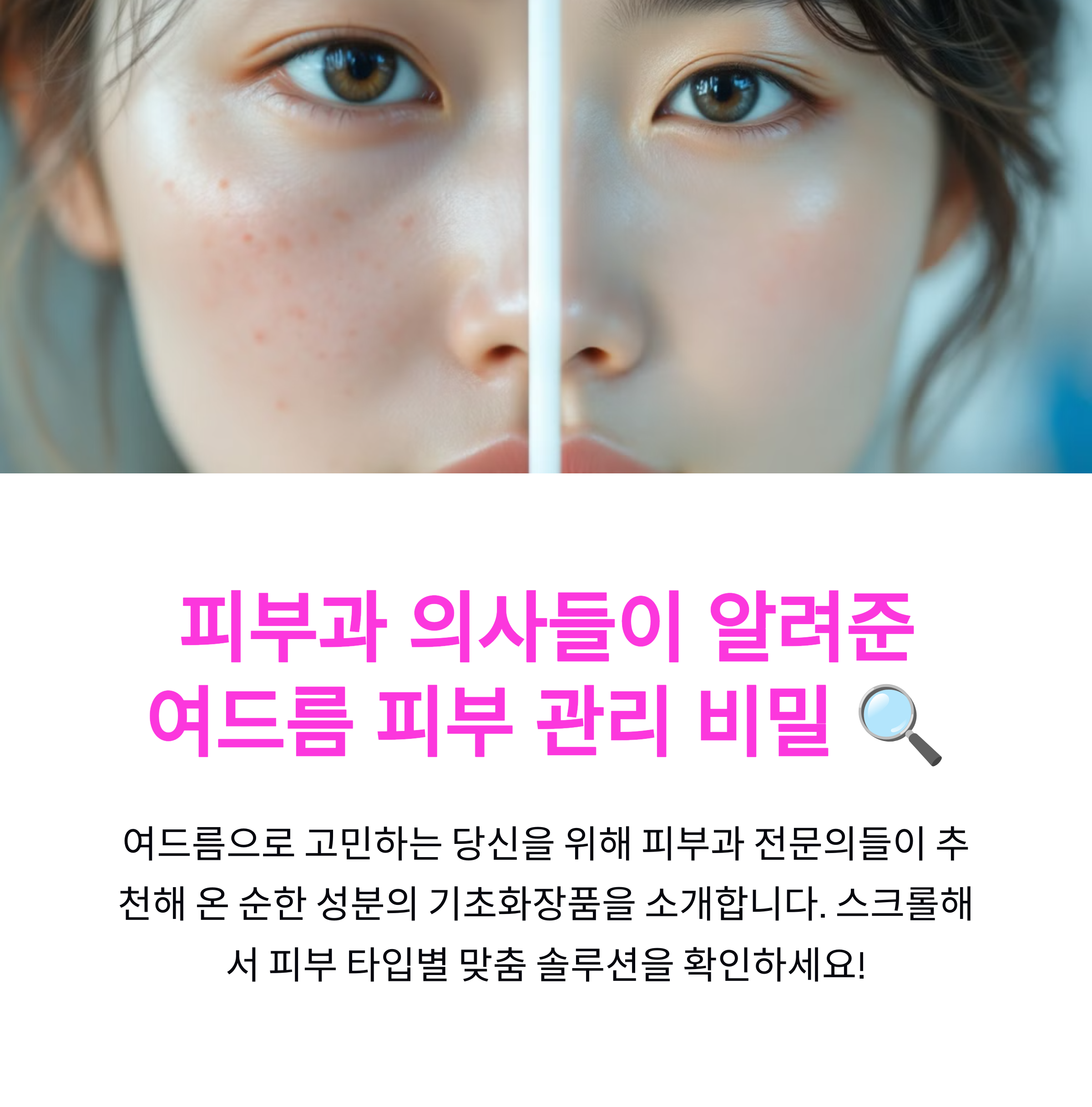 피부과 의사들이 말하는 여드름 피부를 위한 기초화장품 추천, 순한 성분 필수