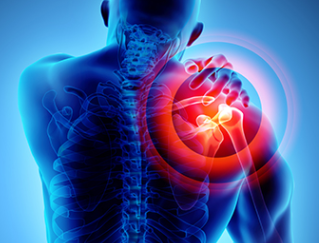 어께통증-이미지