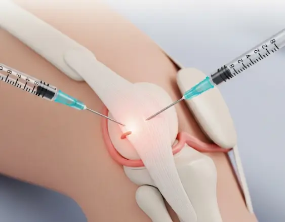 프롤로주사 원리