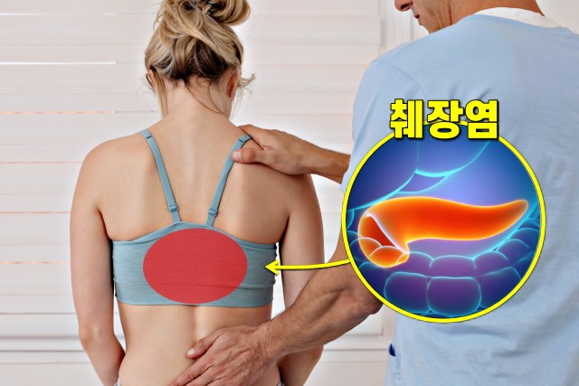 등 위쪽 통증 5, 등이 아픈 증세, 췌장염 증상, 생로병사의 비밀