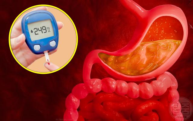 혈당이 높으면 나타나는 증상 위 마비 현상
