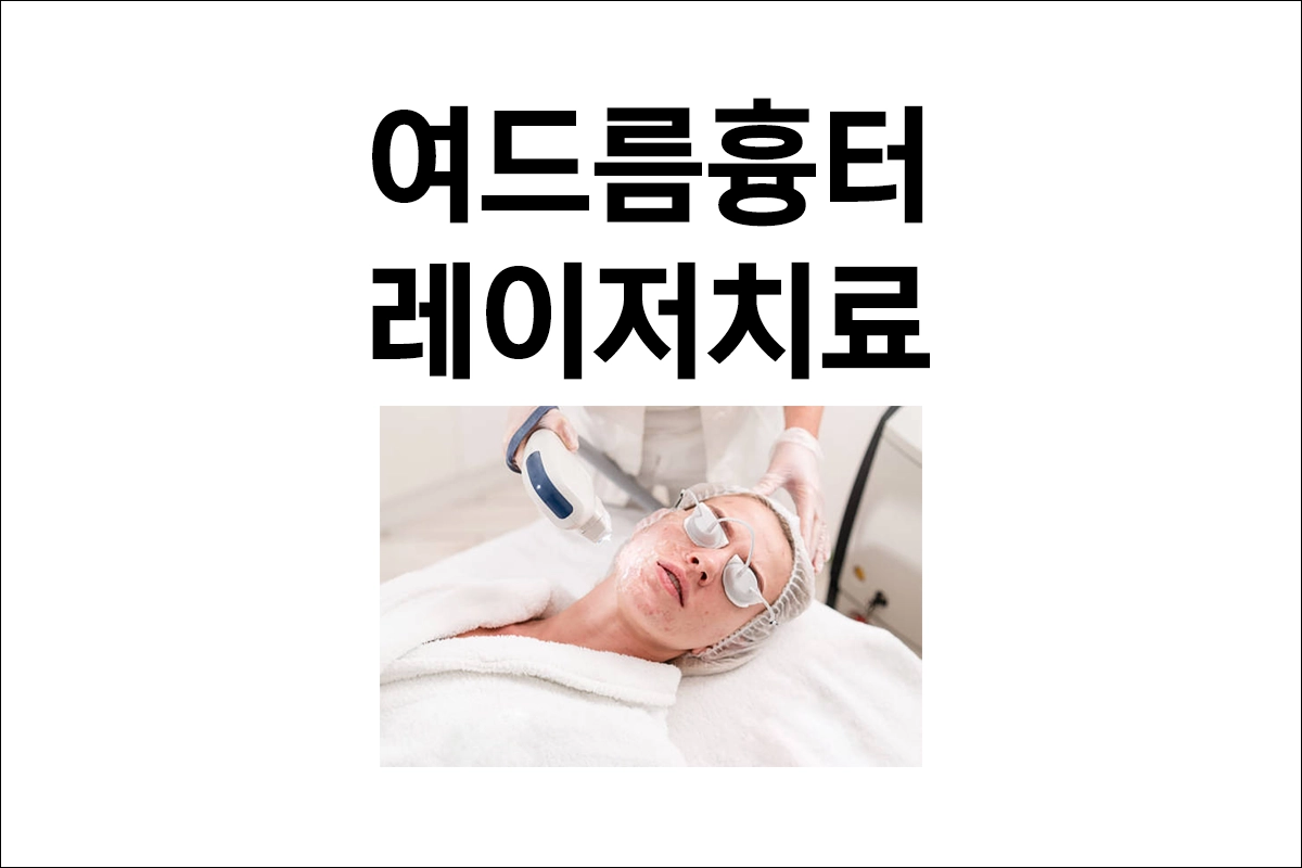 여드름과 흉터 치료 레이저 치료 스무스빔 엑스클리어 스킨케어