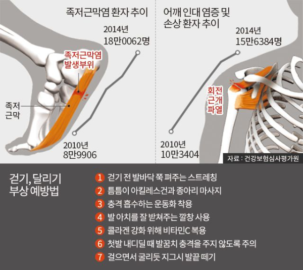 족저근막염에 대한 부위설명과 예방법설명