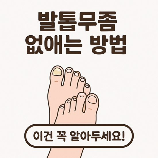 발톱무좀 없애는 방법