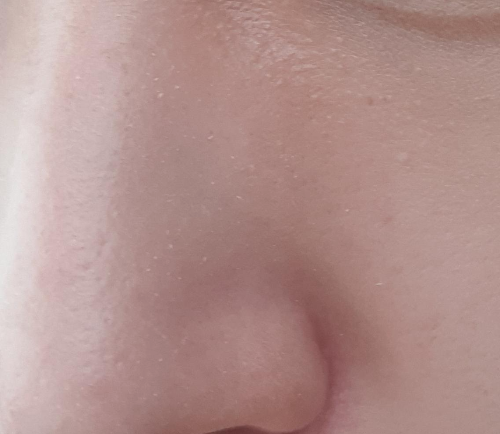 팩트 사용 직후(오른쪽 뺨)