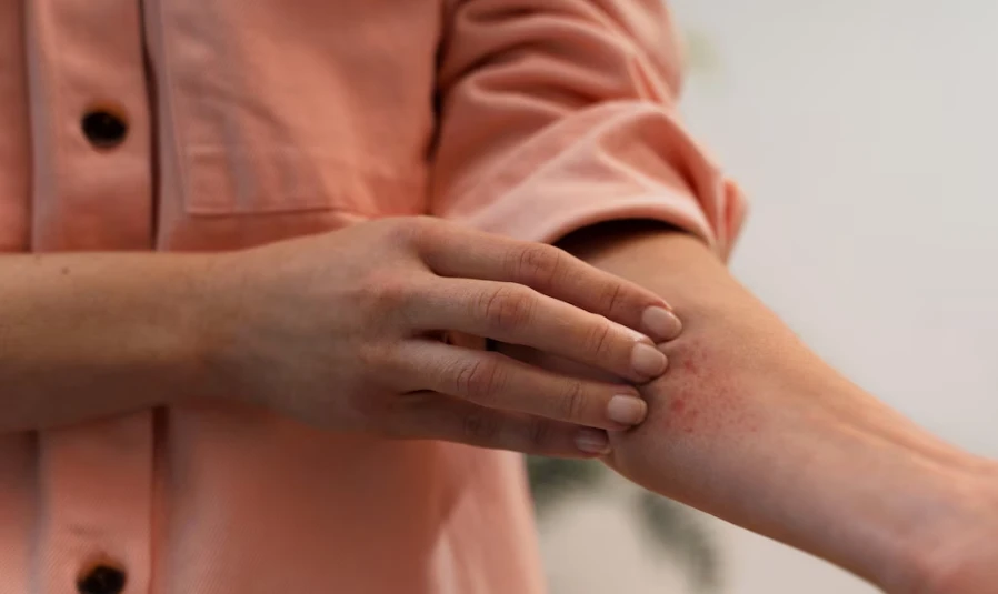 미세먼지 피부 트러블