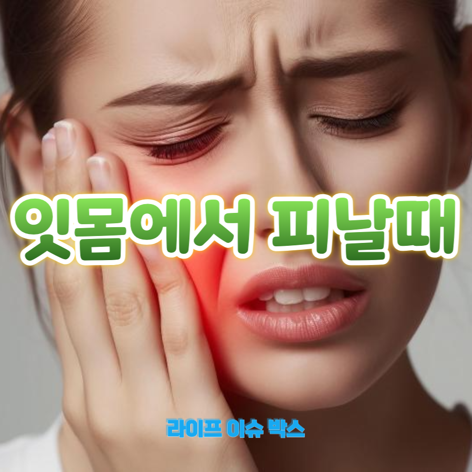 잇몸에서 피날 때