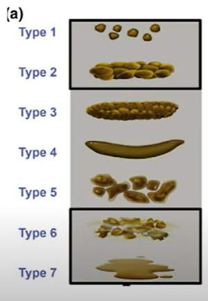 7가지 변의 타입