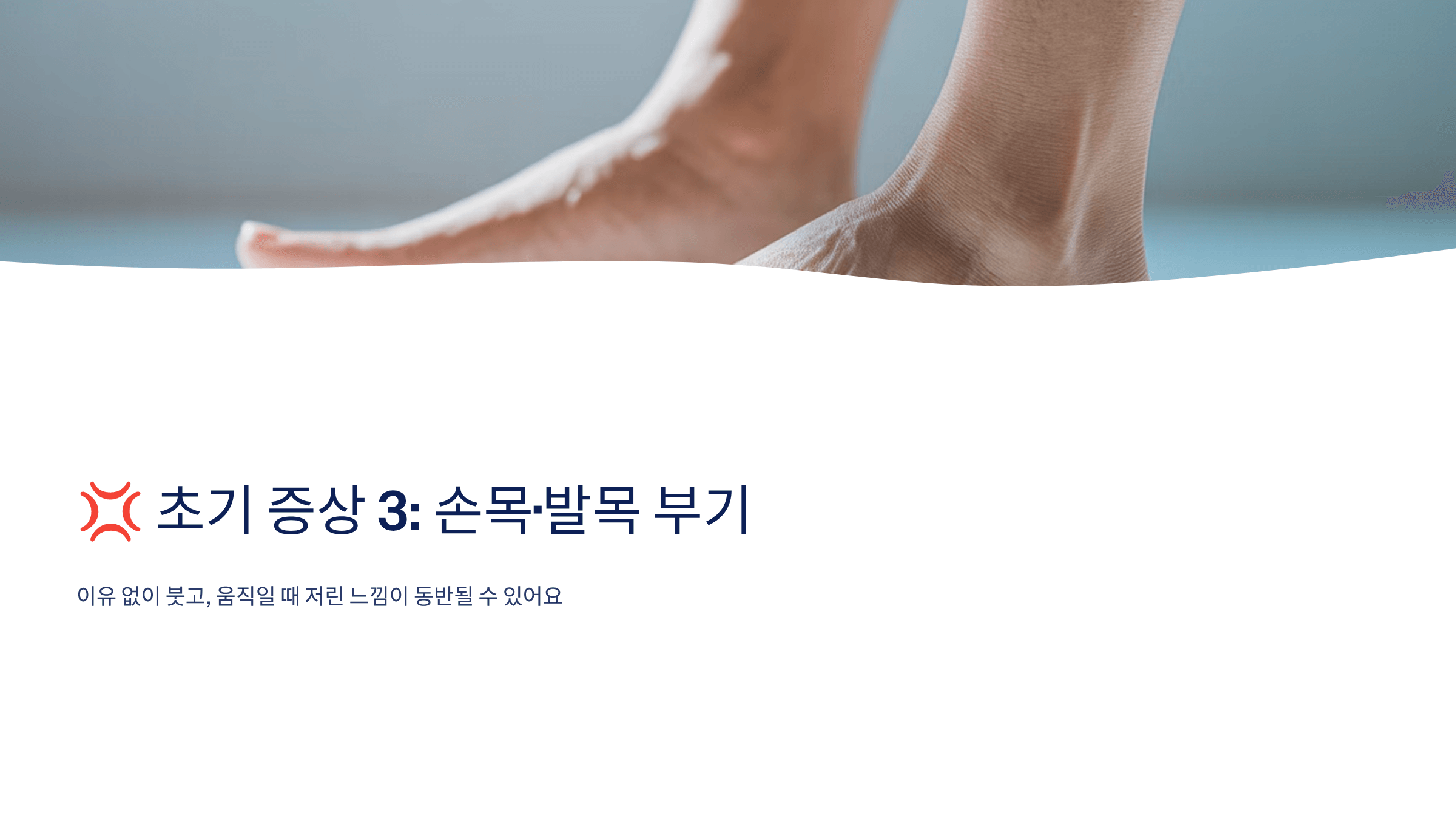 류마티스 관절염 초기증상 사진입니다.