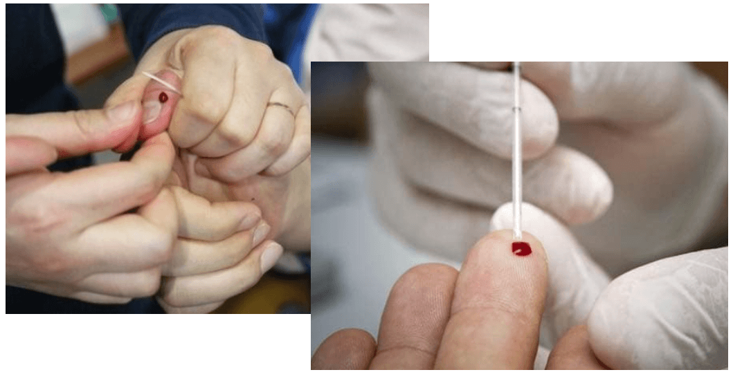 손을-따는-사진