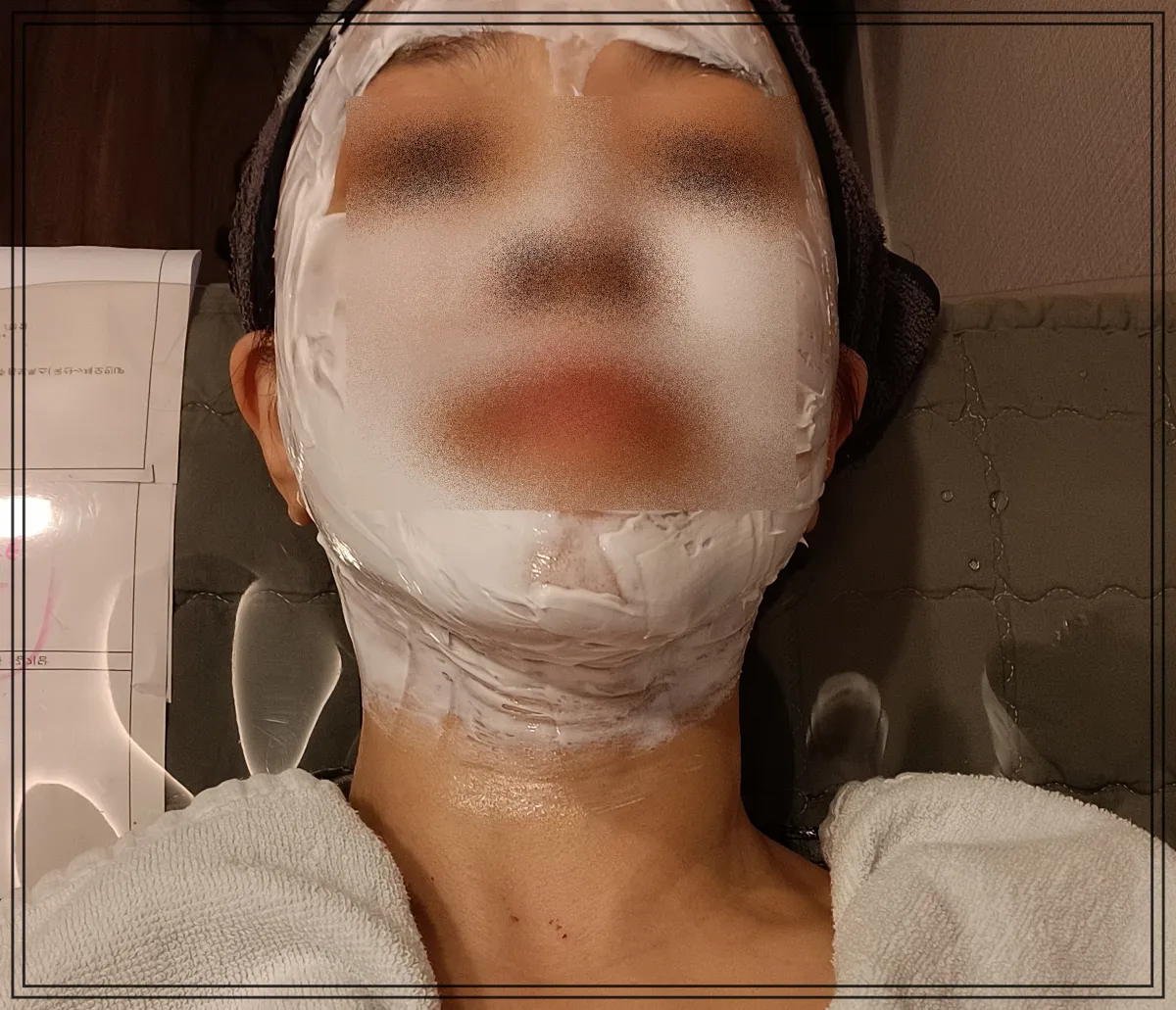 써마지-flx-마취