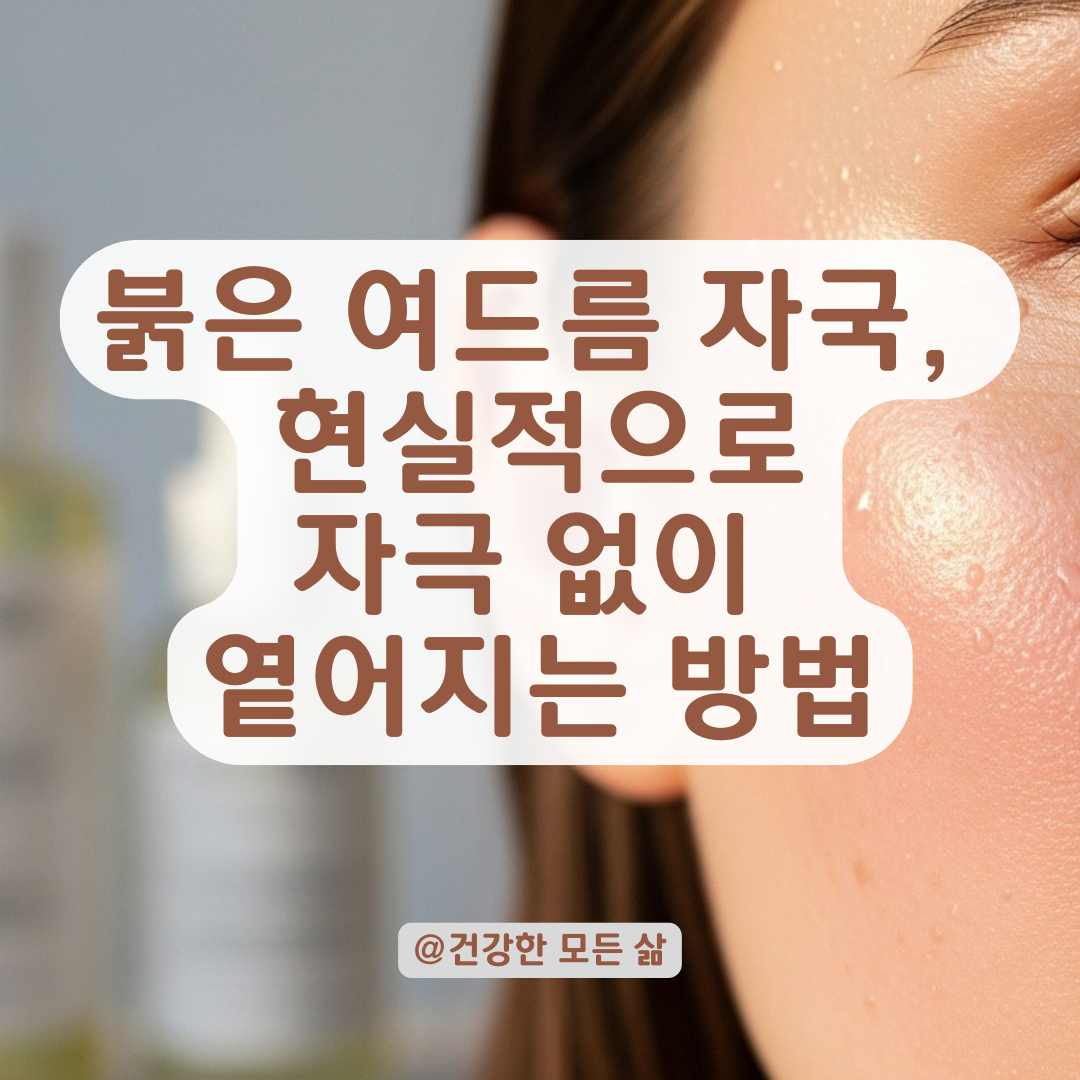 여드름 자국이 빨갛게 남는다면? 색소침착 줄이는 저자극 관리법 정리.