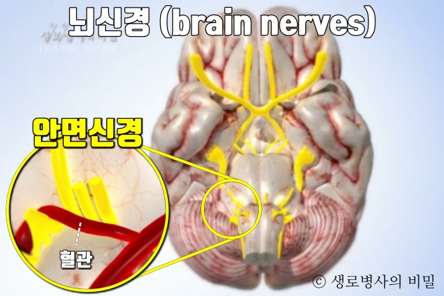 손떨림, 눈떨림, 얼굴떨림, 턱떨림, 뺨떨림 증상 이유 원인