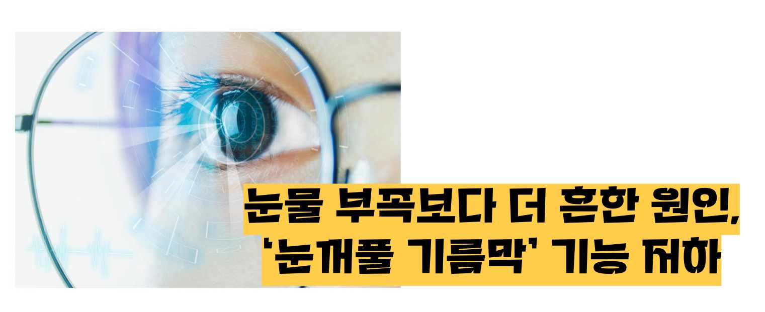 눈이 시리고 눈물이 나는 이유