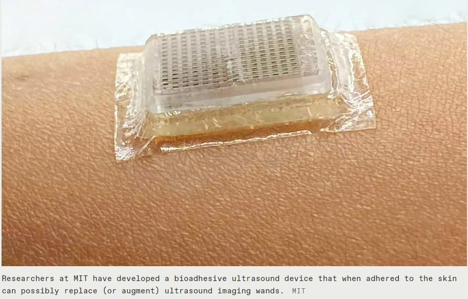 몸 속을 들여다보는 우표크기 초음파 스티커 VIDEO: Ultrasound Stickers Look Inside the Body