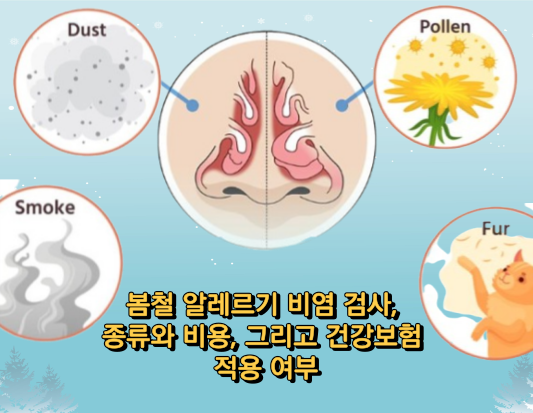 봄철 알레르기 비염 검사&#44; 종류와 비용&#44; 그리고 건강보험 적용 여부