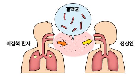 결핵 감염 경로