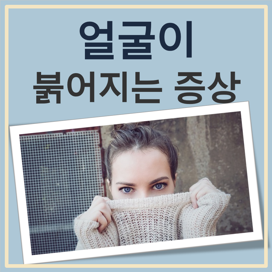 얼굴이 붉어지는 증상 이유 치료법