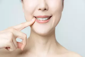 입냄새 제거제