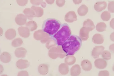 백혈구 수치가 낮은 이유 34