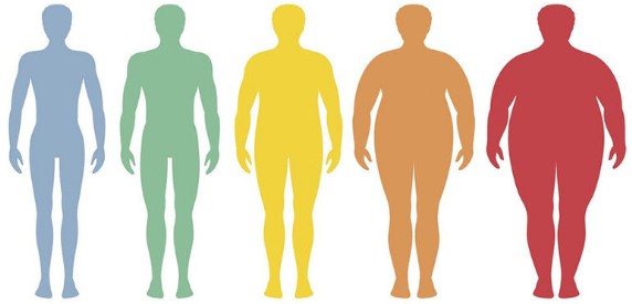 비만기준 - 고도비만기준&#44; 복부비만기준&#44; 소아비만기준