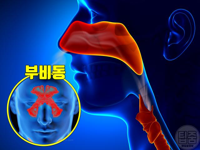 입냄새 심한 이유 입냄새 원인 질환 부비동염