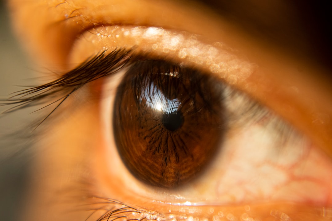 Eyelid