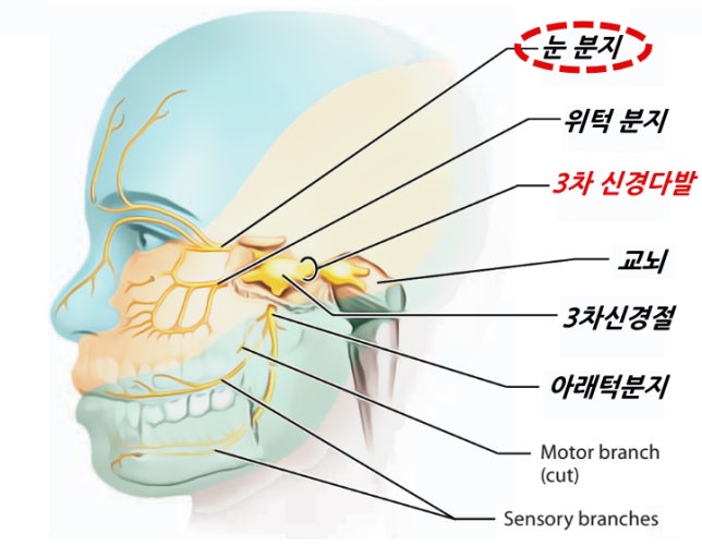 눈 질환 증상별 대처법 (통증, 충혈, 시력저하) 관련 이미지
