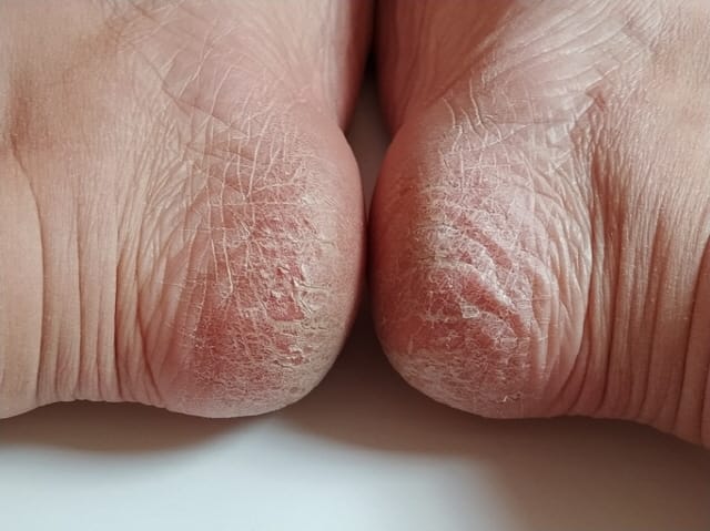 발각질제거기 고르는법 수동 전동 비교