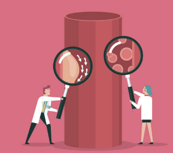 고지혈증에 좋은 음식 나쁜 음식 관리방법 파헤치기