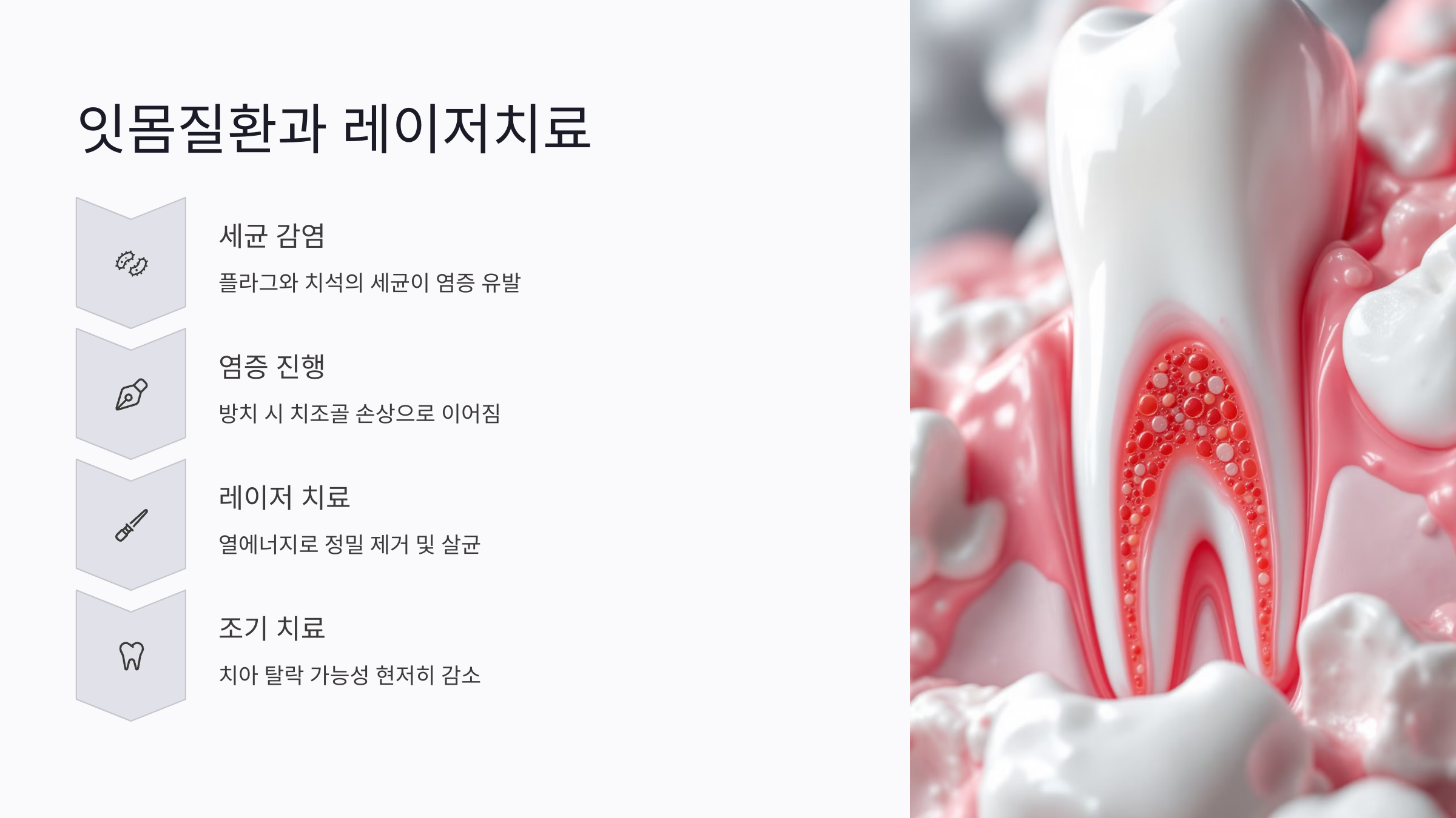 잇몸질환과 레이저치료의 관계