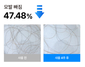탈모앰플 닥터33 