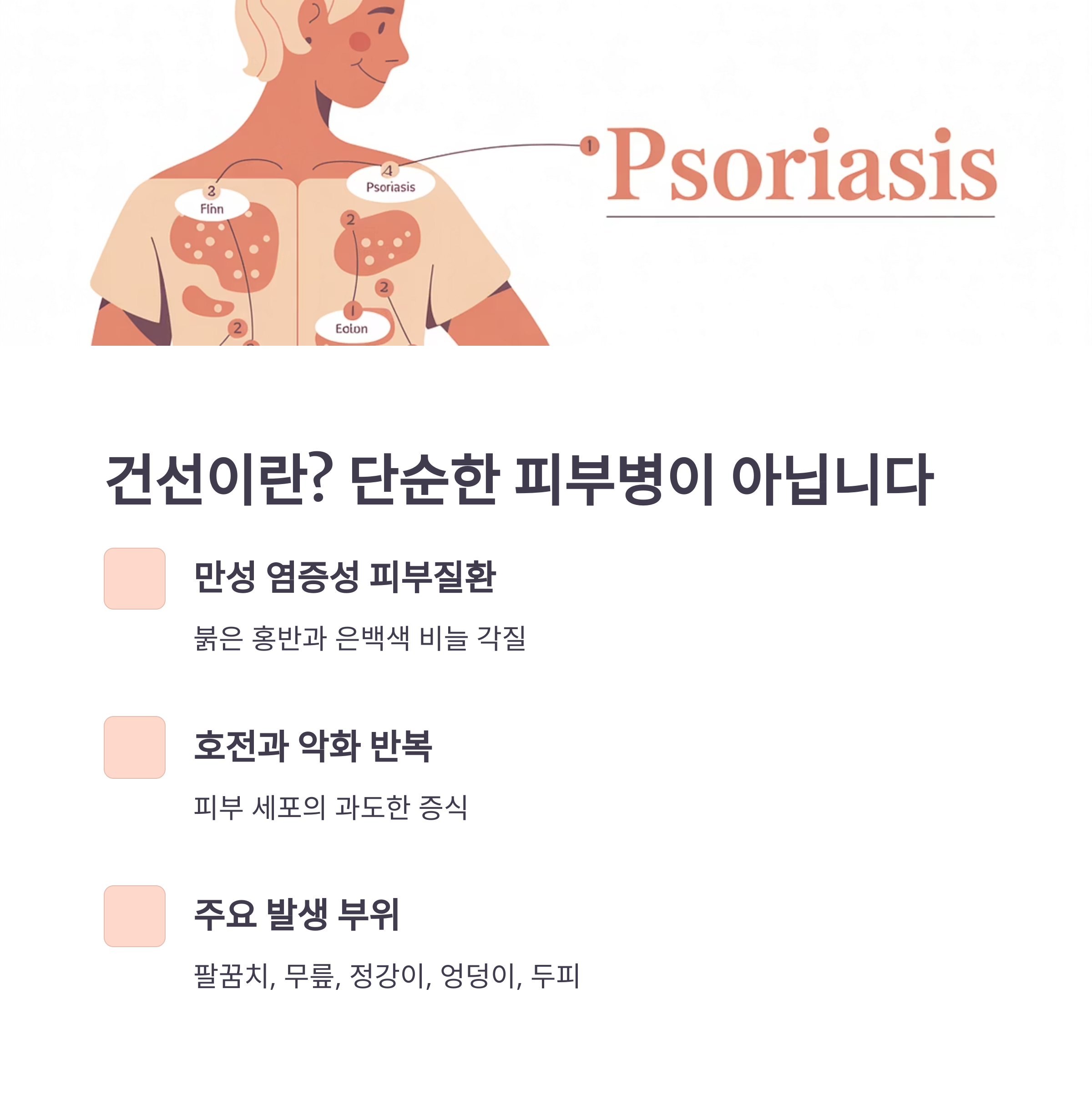 건선의 주요 부위와 증상을 설명하는 일러스트와 함께 만성 염증성 피부질환의 정의를 안내하는 이미지