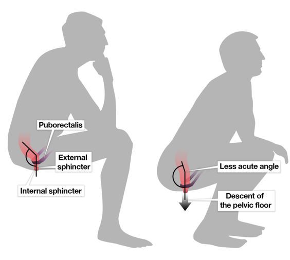 배변 후 관리 체크 이미지