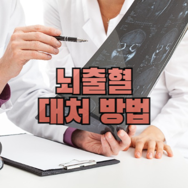 뇌출혈 대처 방법