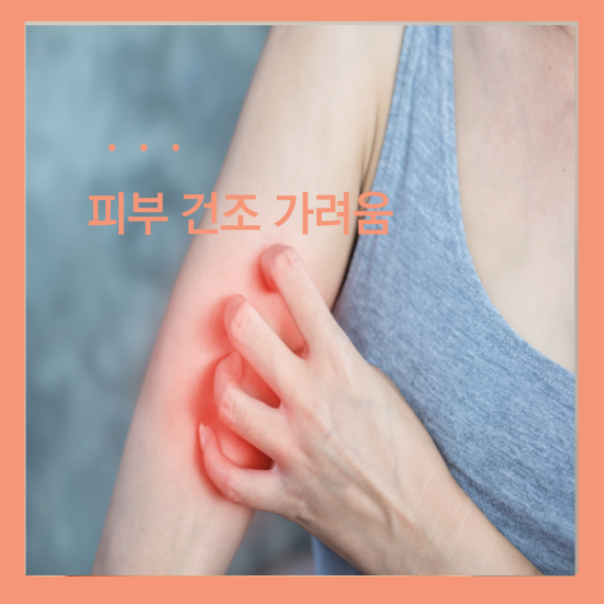 비판텐 연고