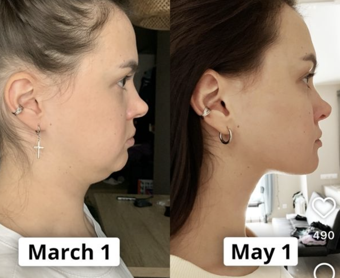 페이스 요가+탄력 디바이스 루틴으로 탄력과 볼륨을 한방에 해결하는법 설명 사진