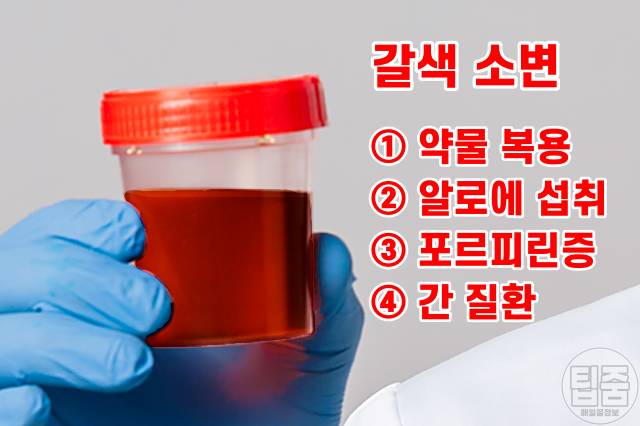 소변색깔 건강상태,소변색깔 갈색 황갈색 검은색,소변색깔이 뿌옇다