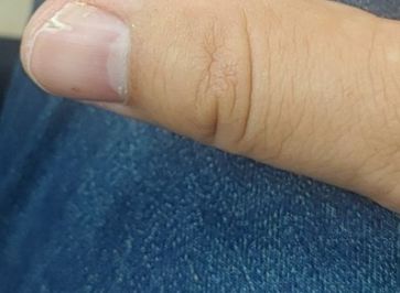 손톱이 잘 부러지는 이유