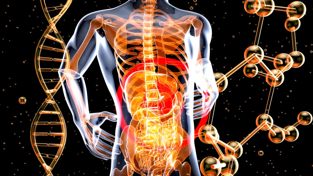 Spinal stenosis.