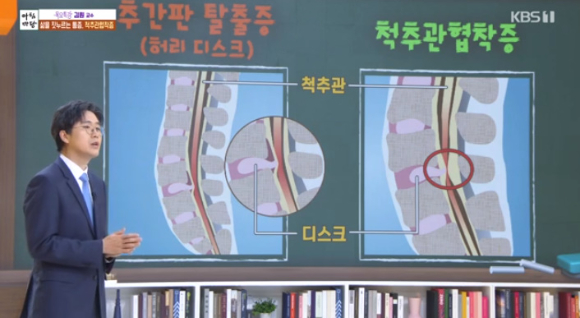 김원 서울아산병원 재활의학과 교수가 &#39;아침마당&#39;에서 강연을 하고 있다.[사진=KBS 방송화면 캡처]