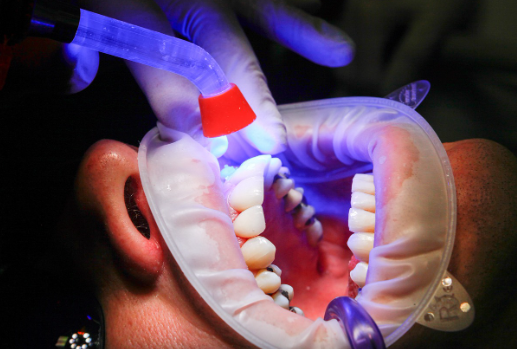 광명 임플란트 싼곳 TOP3비교