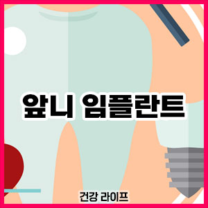 앞니 임플란트