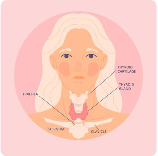 갑상선암을 설명하는 분석 자료