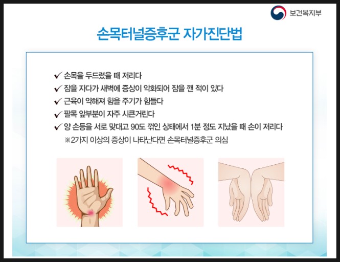 손목터널증후군 자가진단법 사진