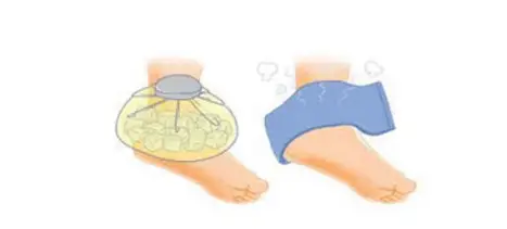 관절염-온찜질-냉찜질