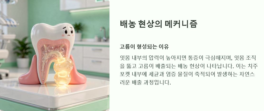 잇몸 염증 고름 치료 민간요법