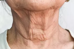 목주름 없애는법